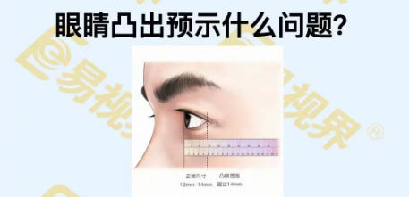 眼睛凸出預示著(zhù)什么問(wèn)題